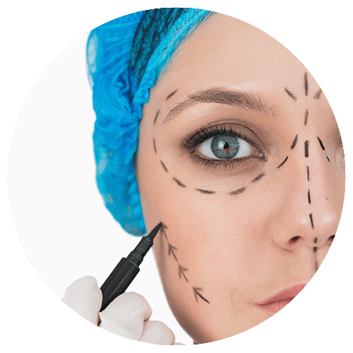 Liposuzione-Viso 2